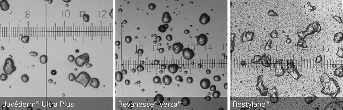 comparison of dermal fillers with Versa clearly showing more spherical particles.